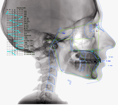 AudaxCeph - Software Ortodontic Complet